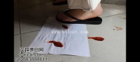 30866  纯儿超近距离走踩小金鱼