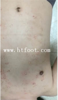TL14761 兔粉粉S的人体脚垫73分钟